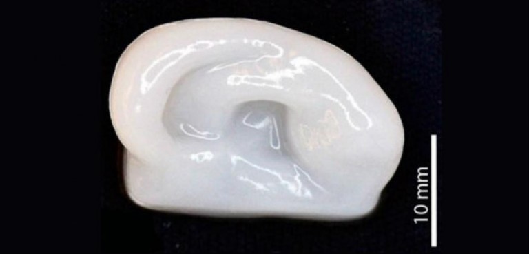 Cartilagem impressa em 3D pode ajudar na reconstrução de membros do corpo