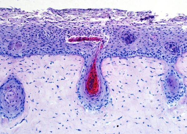 Grupo Boticário anuncia projeto de Pele 3D com Folículo Capilar